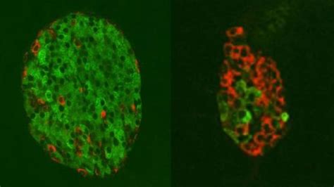 Swapping alpha cells for beta cells to treat diabetes.